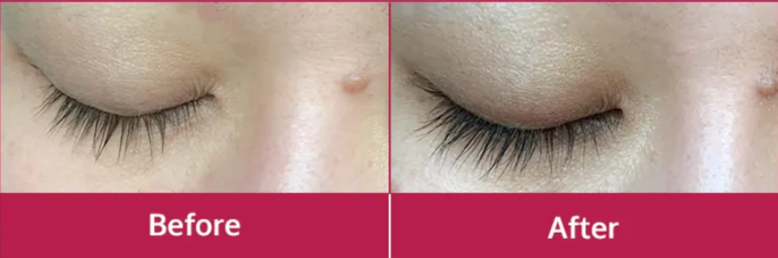 Miracle Lash benefits