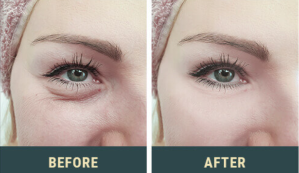 SeriSkin_benefits