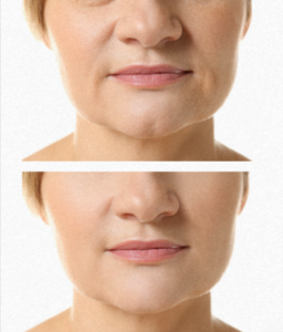 3 Naturals Triple Collagen Customer Result