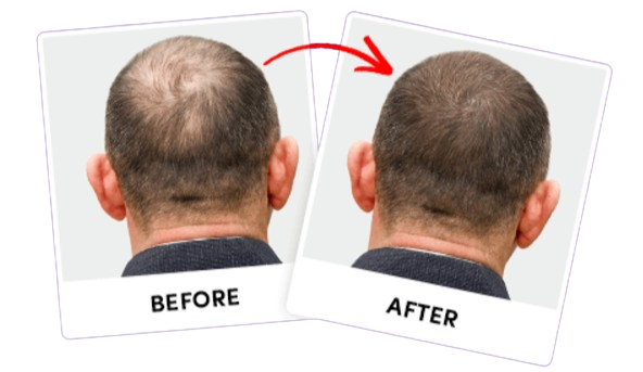 DeRose Revitalize Result