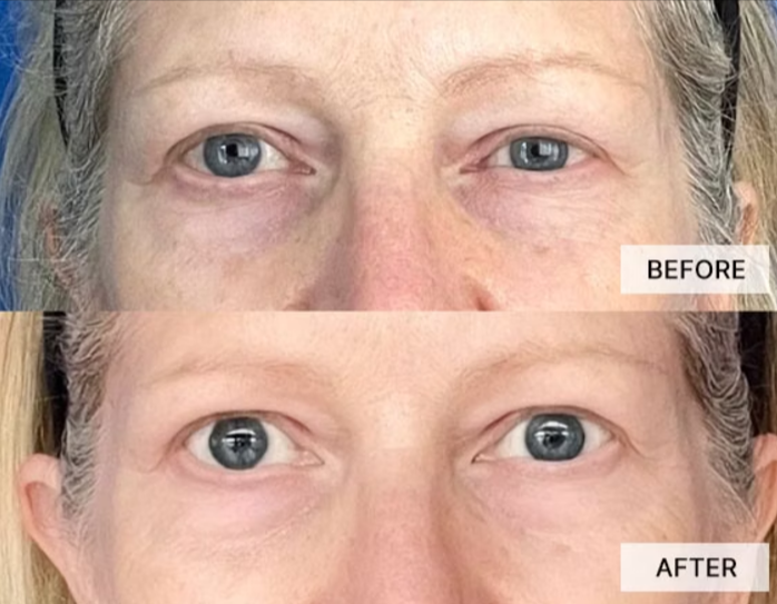Eye Joy Anti Wrinkle Serum Result