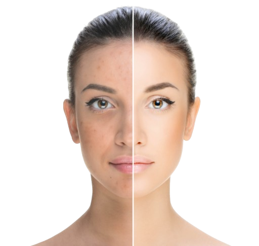 ReFirmance Skin Health Result