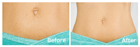 Skinception Benefits
