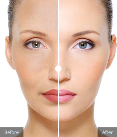 XYZ Smart Collagen Before and After
