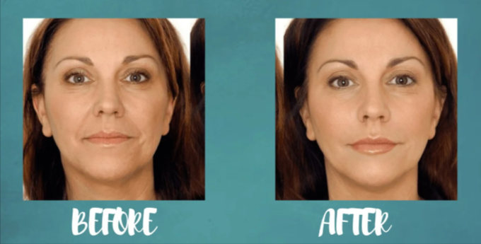 Reactivate Skin Care Before and After