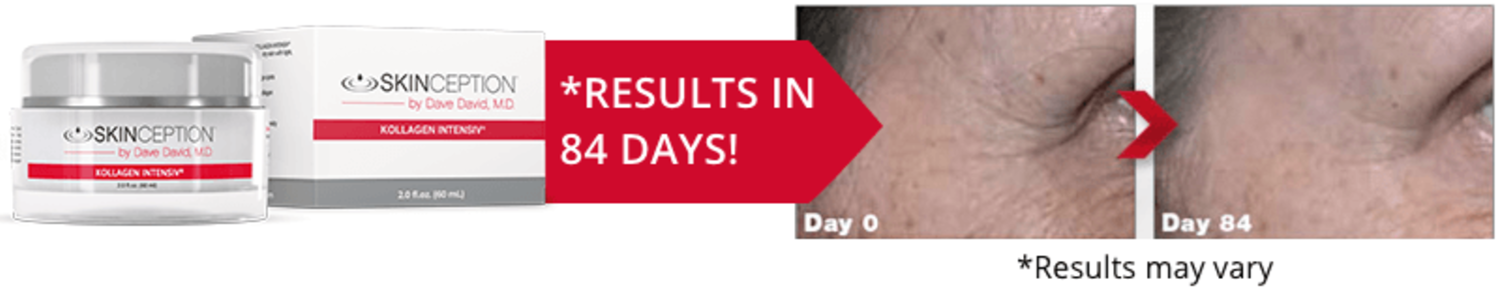 Skinception Kollagen Intensiv Cream Result
