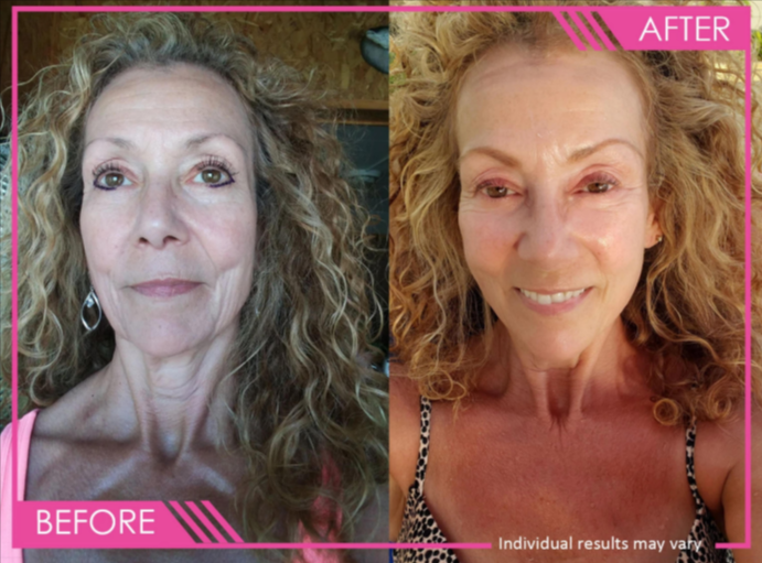 Vital Promise Vitamin C Serum Results