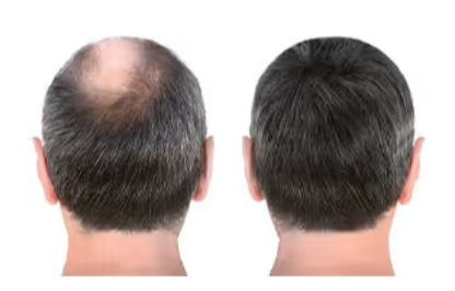 CelluHair-Spray-Customer Reviews