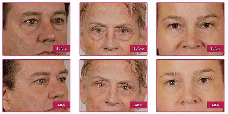 beforeandafterpics